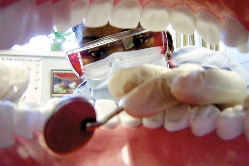 cirugia-dental-sin-bisturi